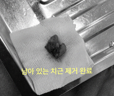 그림10