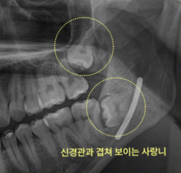 그림4