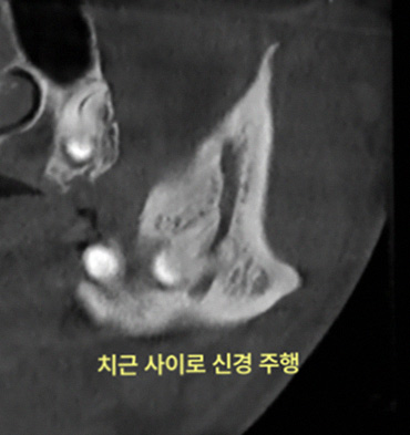 그림5 1