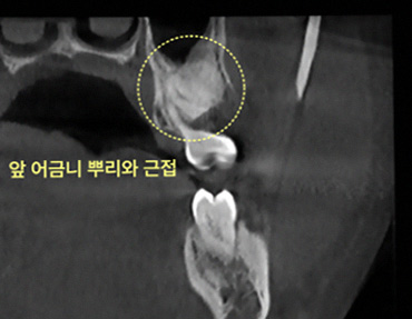가정동치과 