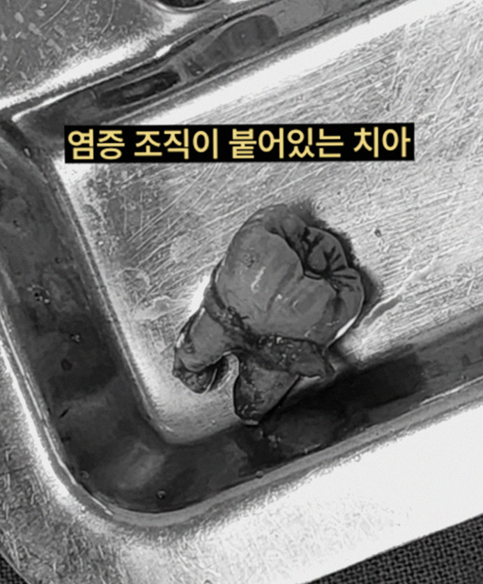 그림23
