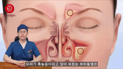 치과 의사가 부비동염에 대해 설명하는 애니메이션 영상.