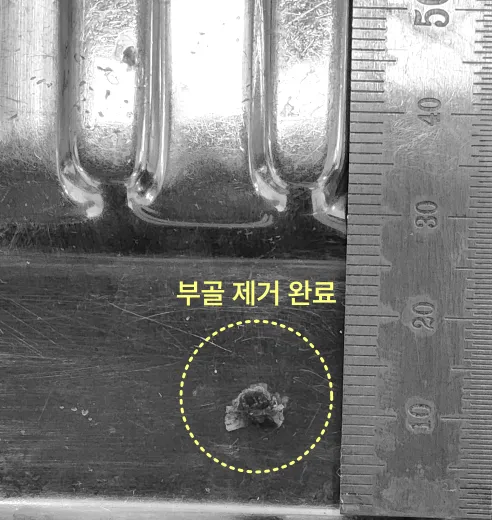 구월동치과 축농증이 안 낫는다면 이것 때문일 수 있어요