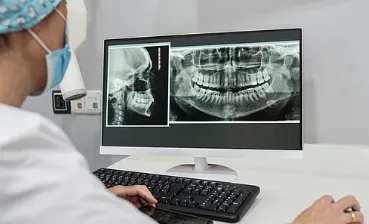 매복 사랑니에 CT 촬영이 필요한 경우는 언제인가요? 8 의사가 컴퓨터로 치과 엑스레이를 확인하는 모습