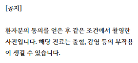 사랑니 옆 물혹: 단순 염증이 아닐 수 있습니다