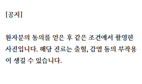 사랑니 방치, 앞 어금니 뿌리까지 녹는 치근 외흡수 위험