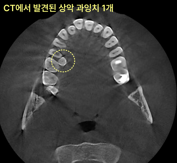 가정동치과 신경치료 병원 추천 기준 7 가정동치과 신경치료 병원 추천 기준 관련 사진 5