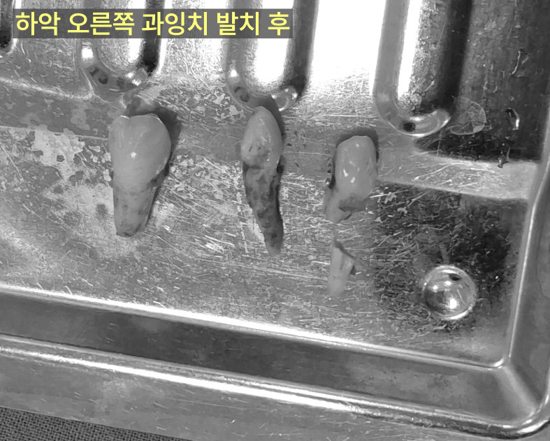 가정동치과 신경치료 병원 추천 기준 9 가정동치과 신경치료 병원 추천 기준 관련 사진 7