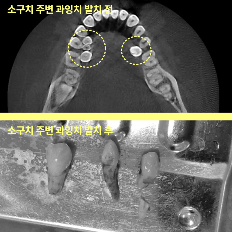 가정동치과 신경치료 병원 추천 기준 11 가정동치과 신경치료 병원 추천 기준 관련 사진 9