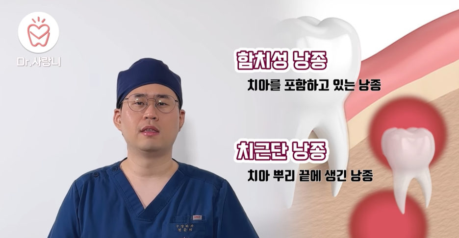 치아 모형과 함께 함치성 낭종 및 치근단 낭종에 대한 설명이 있는 화면