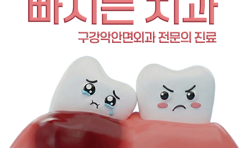 매복 사랑니가 인접 치아를 밀어내어 잇몸 출혈이 발생한 모습을 묘사한 치과 일러스트